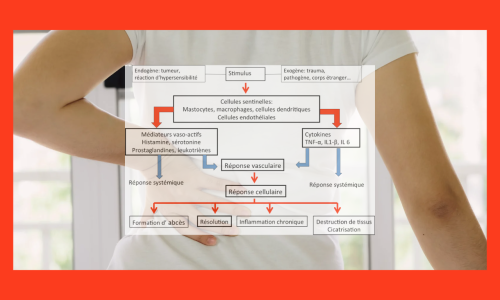 L’inflammation