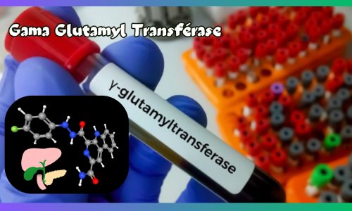 Gama Glutamyl Transpeptidase